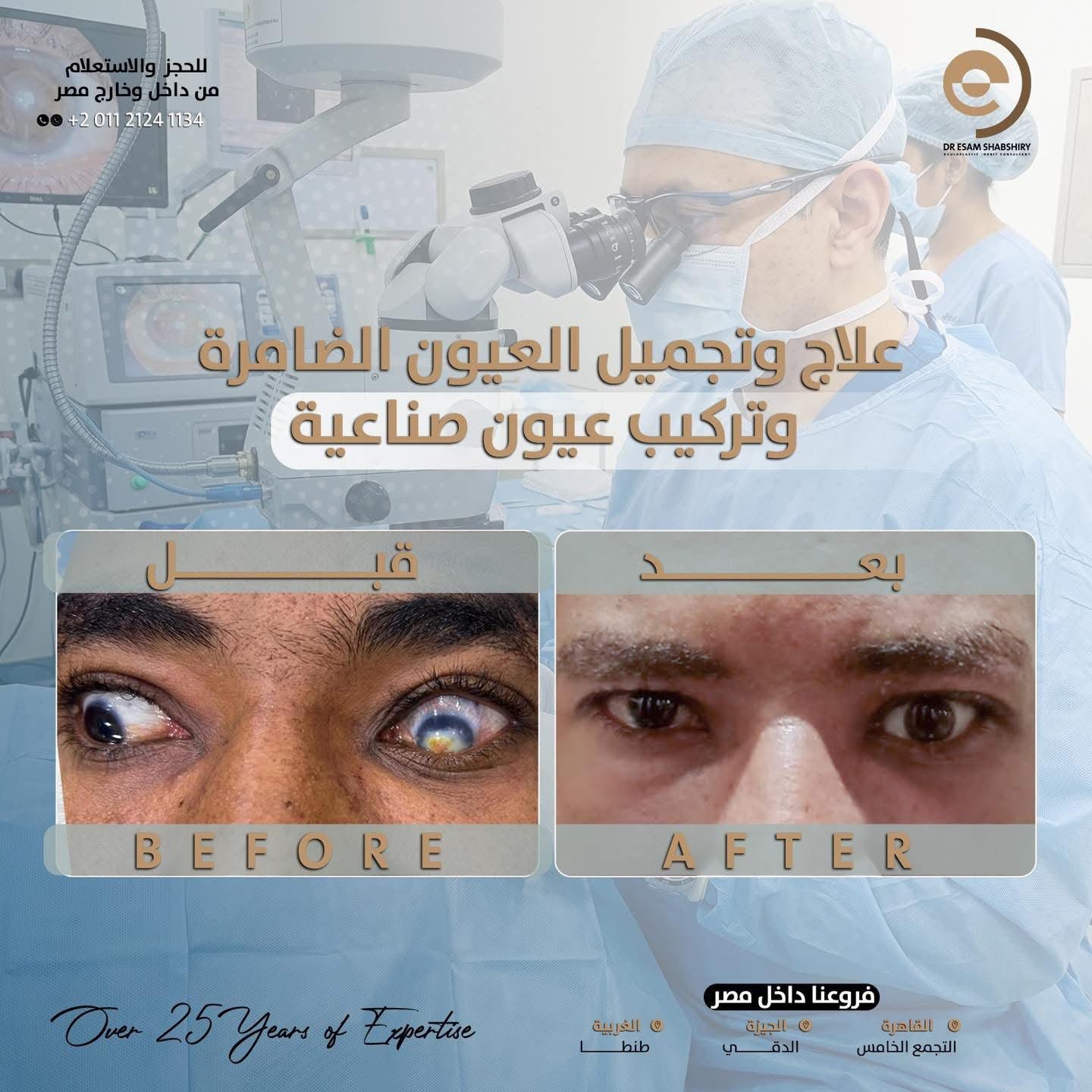 ضمور العين