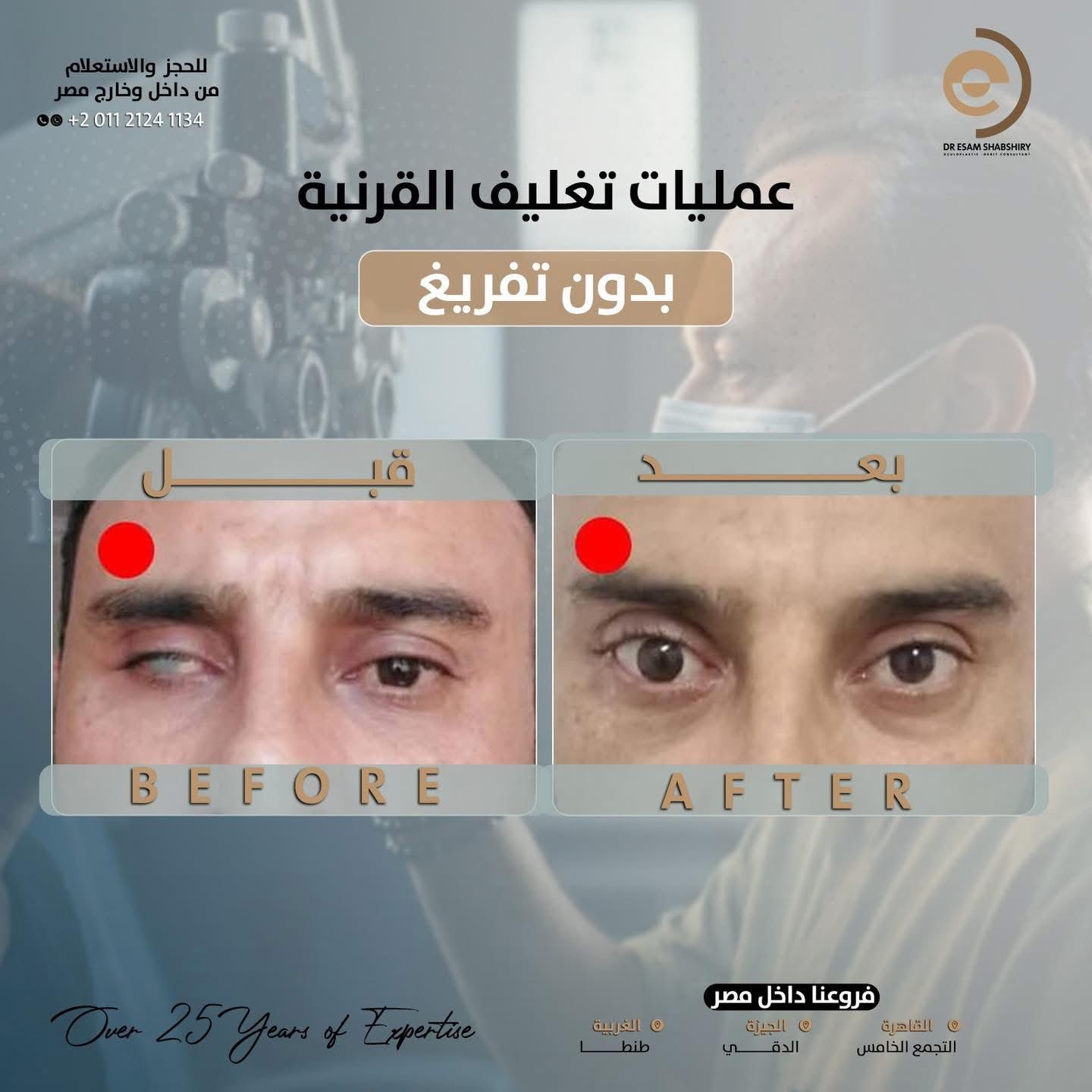 تغليف وترميم القرنية التالفة وحمايتها
