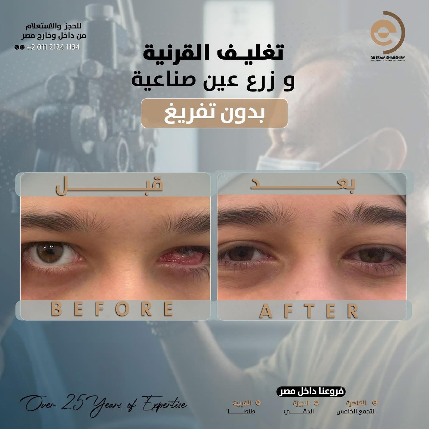 استعادة الشكل الطبيعي وتماثل العينين بعد الضمور