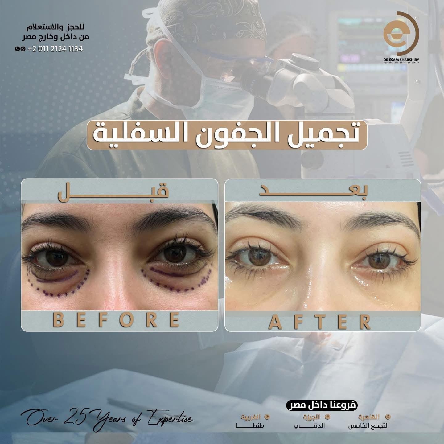 إصلاح ترهل الجلد الزائد بدون ندبات ظاهرة