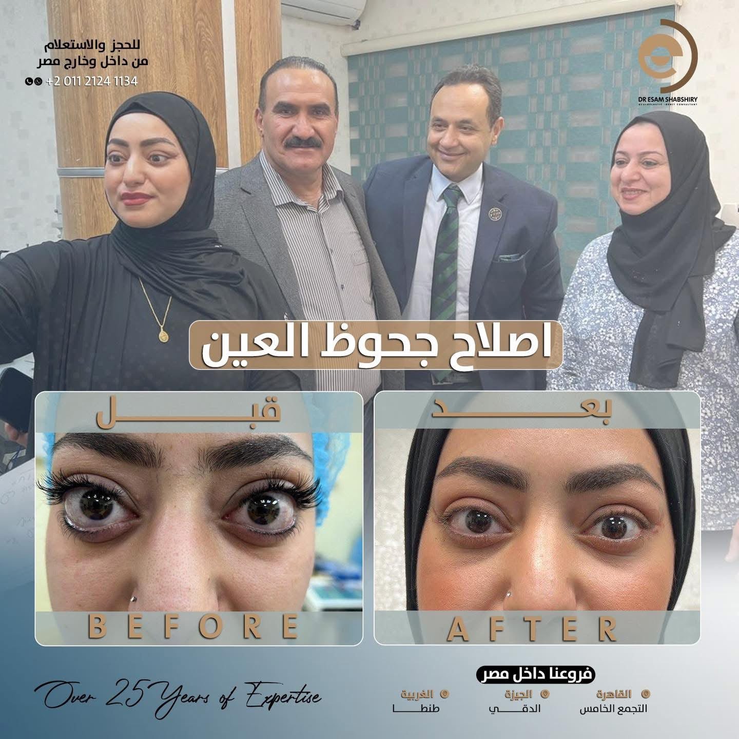 تحسين المظهر الجمالي وتقليل البروز الأمامي